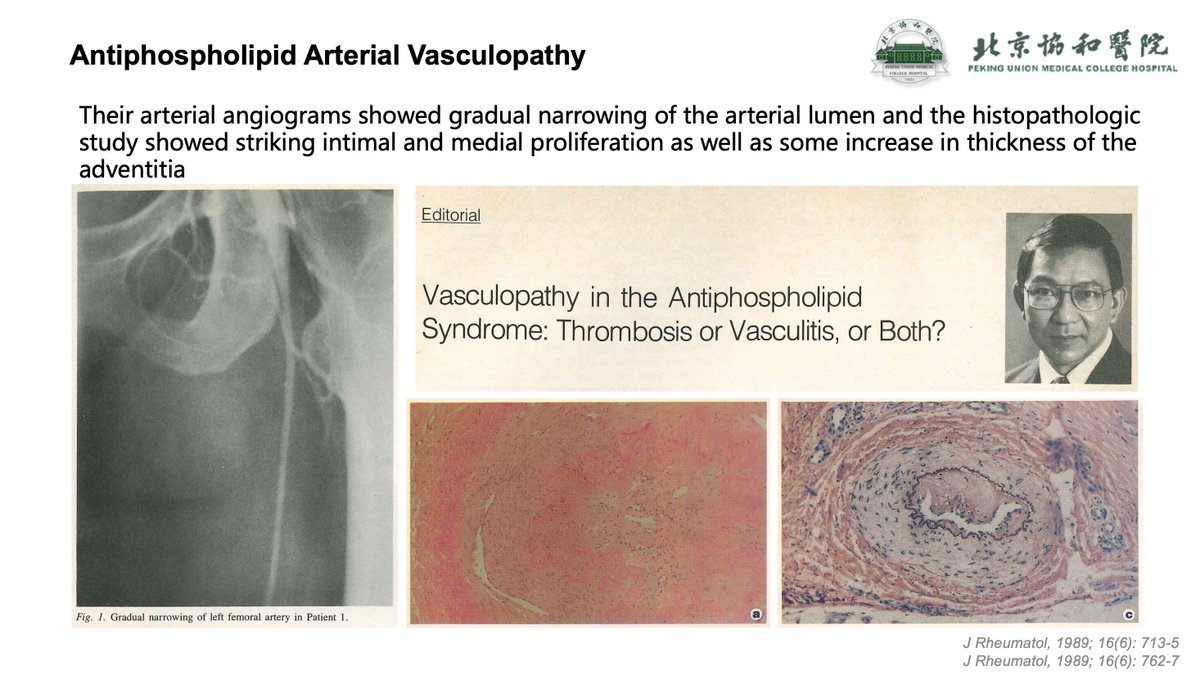 See you next week on ICAPA congress in Kyoto