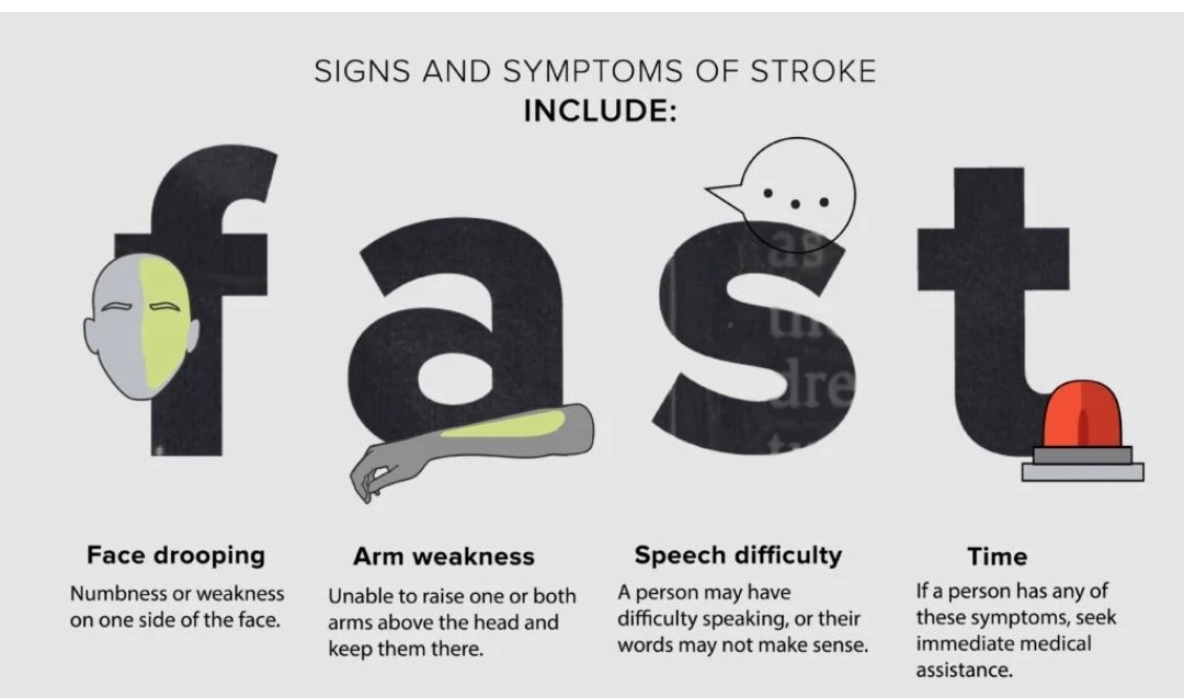 NaphtaliPhysio's tweet photo. The signs and symptoms of stroke are generally the same for males and females. 

They include face drooping, weakness on one side, vision changes, confusion, and difficulty speaking.

Ps.Stroke does not always show obvious signs, silent strokes occur without noticeable symptoms. https://t.co/pPV9N8Unvt