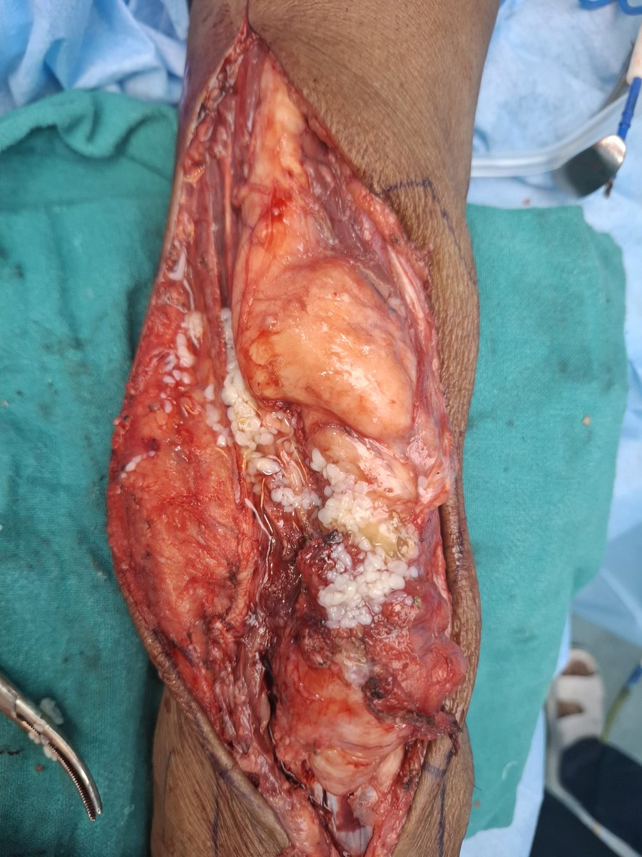 Umesh Yadav tweet media