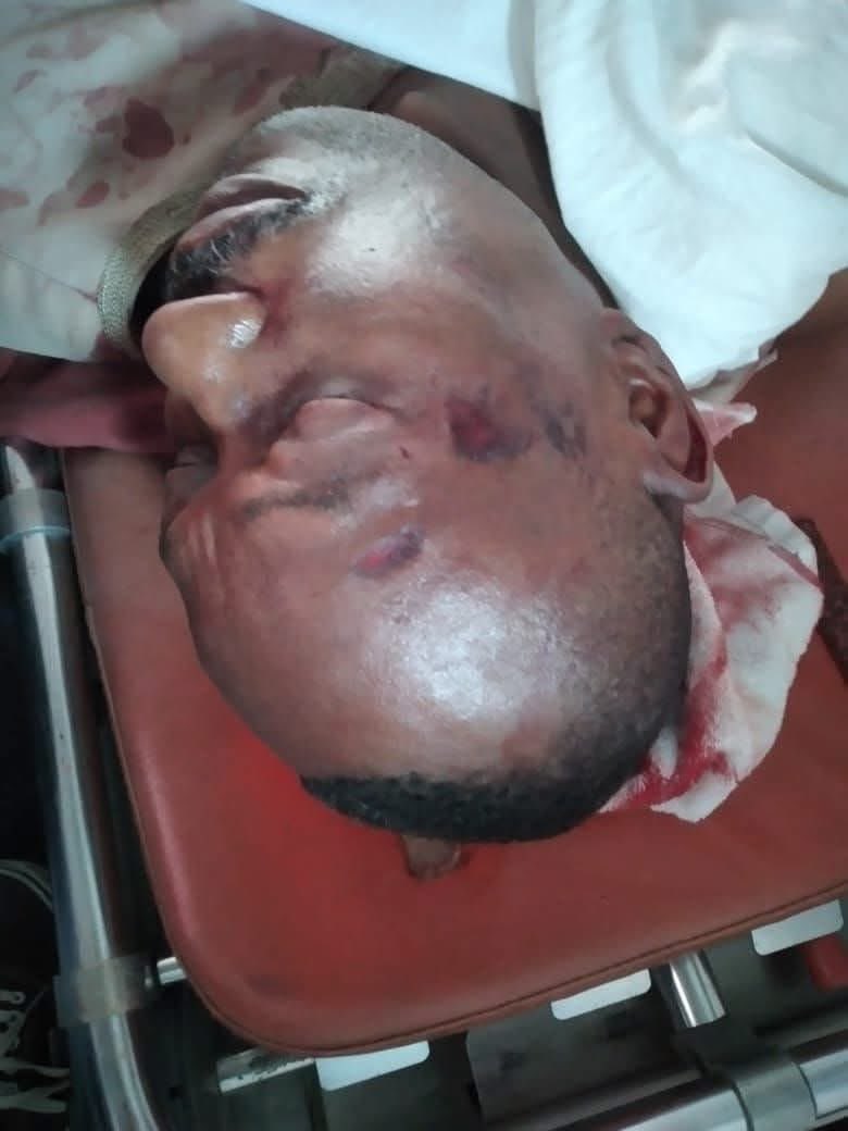 How Ondo SDP Ex-Gov Candidate Akingboye Was Pushed By Wife From Balcony Leading To Death – Source💔💔💔💔

One of the wives of the former candidate of the Social Democratic Party in the November 16, 2024, Ondo State governorship election, Bamidele Akingboye has been accused of