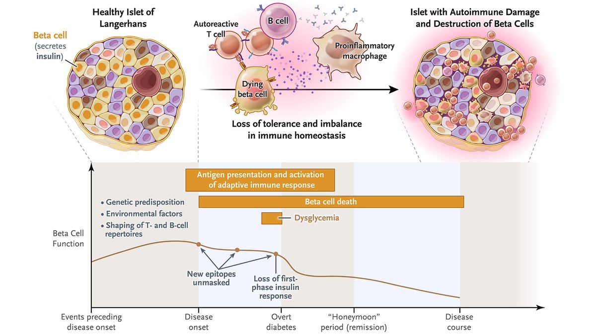 𝐓𝐲𝐩𝐞 𝟏 𝐝𝐢𝐚𝐛𝐞𝐭𝐞𝐬 is a chronic autoimmune disease caused by the immune-mediated destruction of insulin-producing pancreatic beta cells. After beta cells are destroyed, lifelong insulin replacement is required. Physiological consequences of inadequate handling of