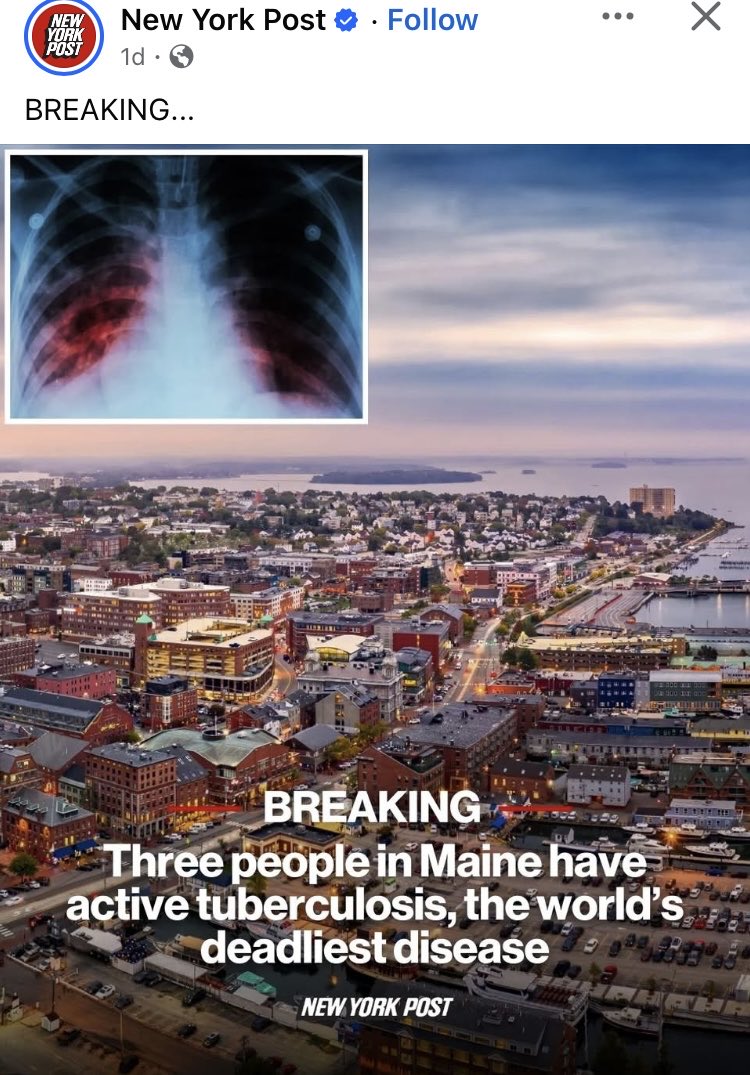 Three people in Maine have active tuberculosis which is one of the World’s deadliest diseases! Well I guess we all know who to thank for this RFK Jr! 😡😡😡