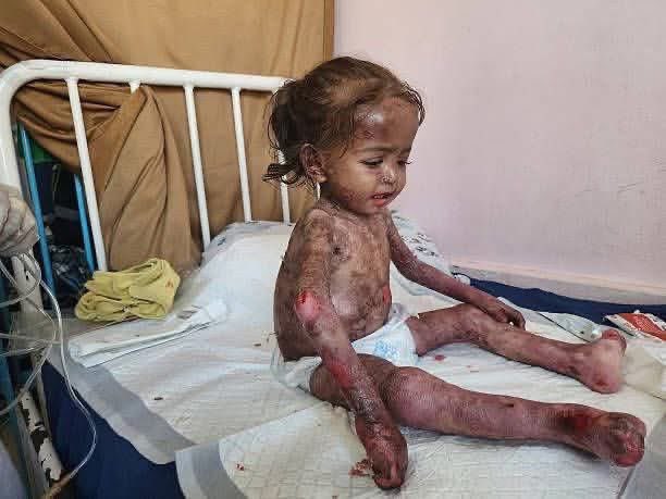 RTElice_'s tweet image. Paylaşın bunu gözü kör dünyanın gözüne sokun! 😓

Allah be/anı versin İsrail...