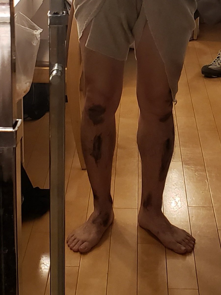 １日2ステ+アフタートークを終え折り返しを越えて、あと残すところ二回。俺のいろんな全部を出しきろう。
#リア王2025