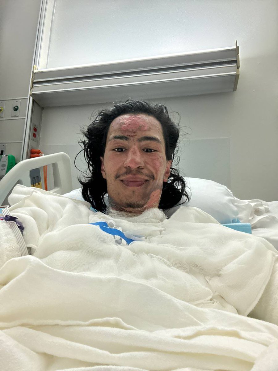 fomo 🧠 tweet media