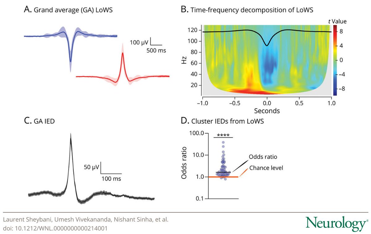 Dynamic Interplay Between Wake Slow Waves and Epileptiform Discharges in the Epileptogenic Zone
hubs.la/Q03H9VCZ0