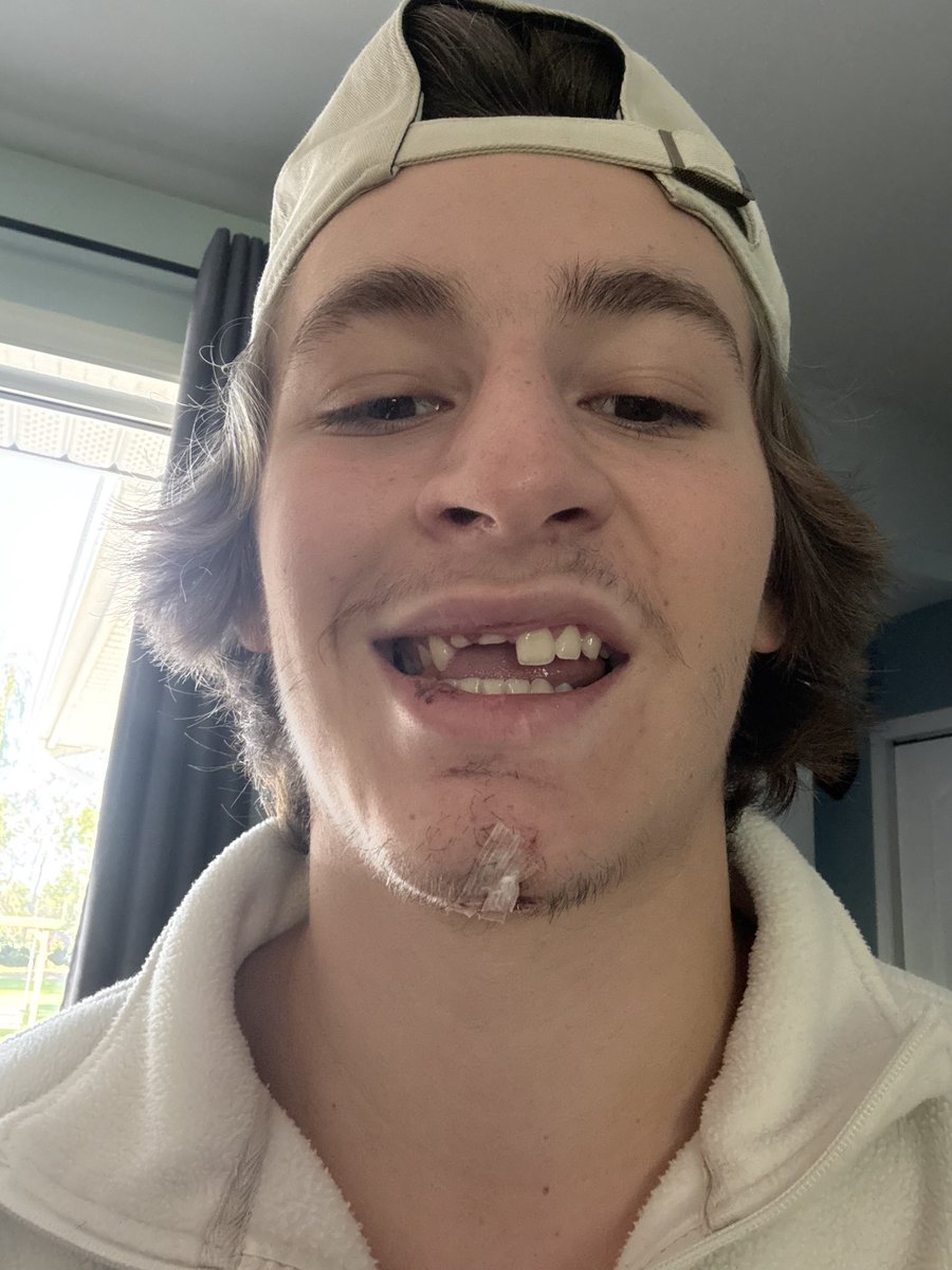 Looking a little better today after a day at the dentist 
Tough practice for the kid 

A face only a mother could love 🥰