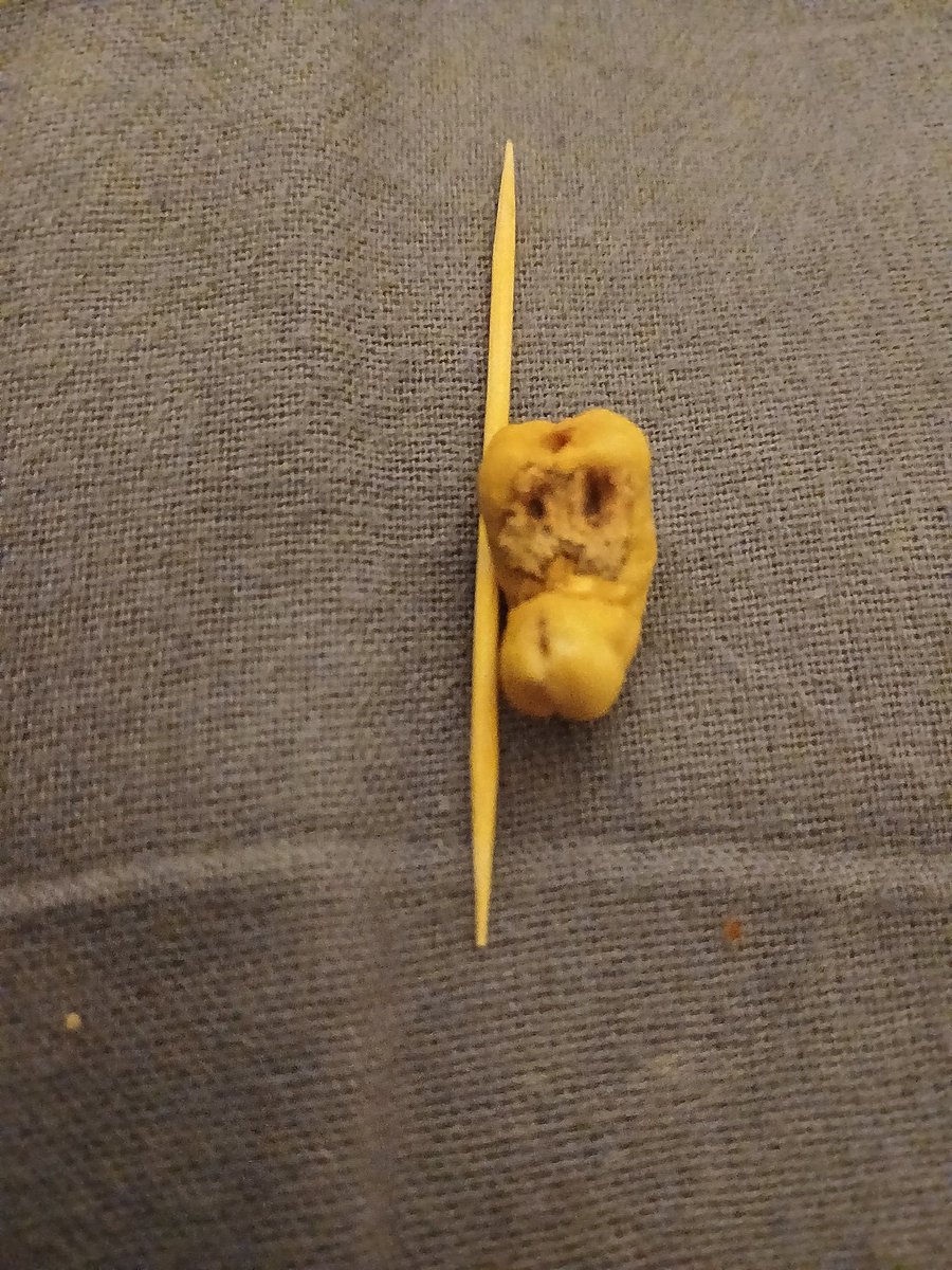 Gozleri var , burnu var . Kajucuc