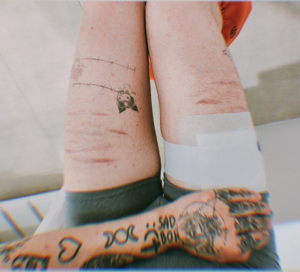 i fucked up i walked into my moms room with my bandage showing 🤦🏻‍♂🤦🏻‍♂