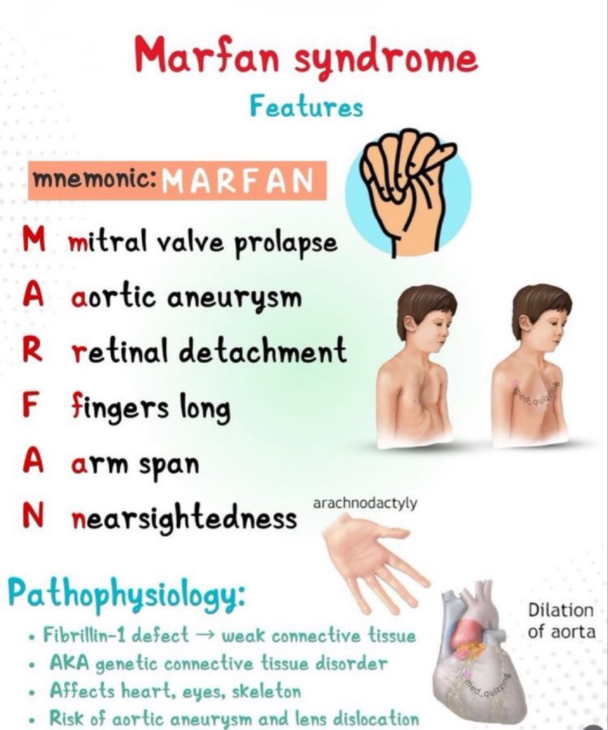 Marfan Syndrome 🧣

#Features 
👀🫥👀