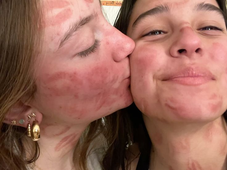 vickaofudida's tweet photo. meu sonho é encher o rosto da minha futura mulher de beijinhos com batom https://t.co/uGG6ZwiuyP