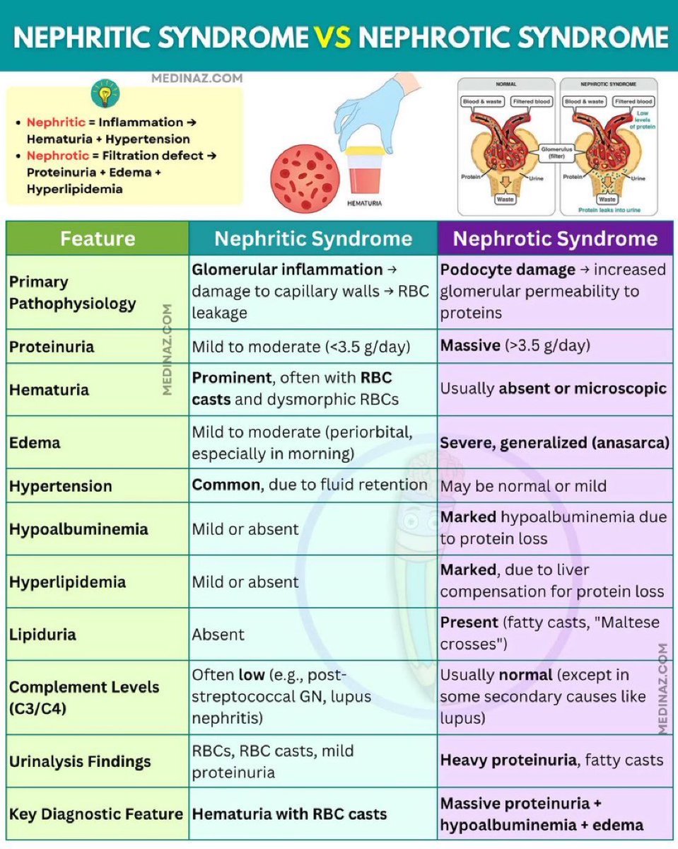 Nephrotic vs Nephritic Syndrome 🩸 

🍃🍃🍃