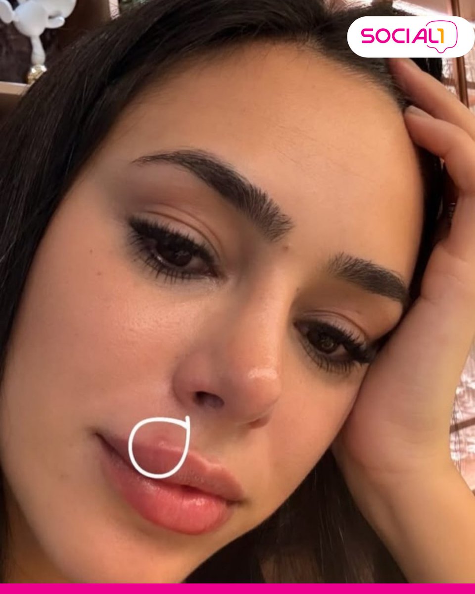 blogsocial1's tweet image. Bruna Biancardi foi a um jogo da NFL com Neymar Jr., mas usou uma máscara para esconder o resultado de um erro: ela espremeu uma espinha que infeccionou e virou uma &quot;celulite facial&quot;.

📸 Instagram

#BrunaBiancardi #NeymarJr #Skincare  co

 digital
#digital