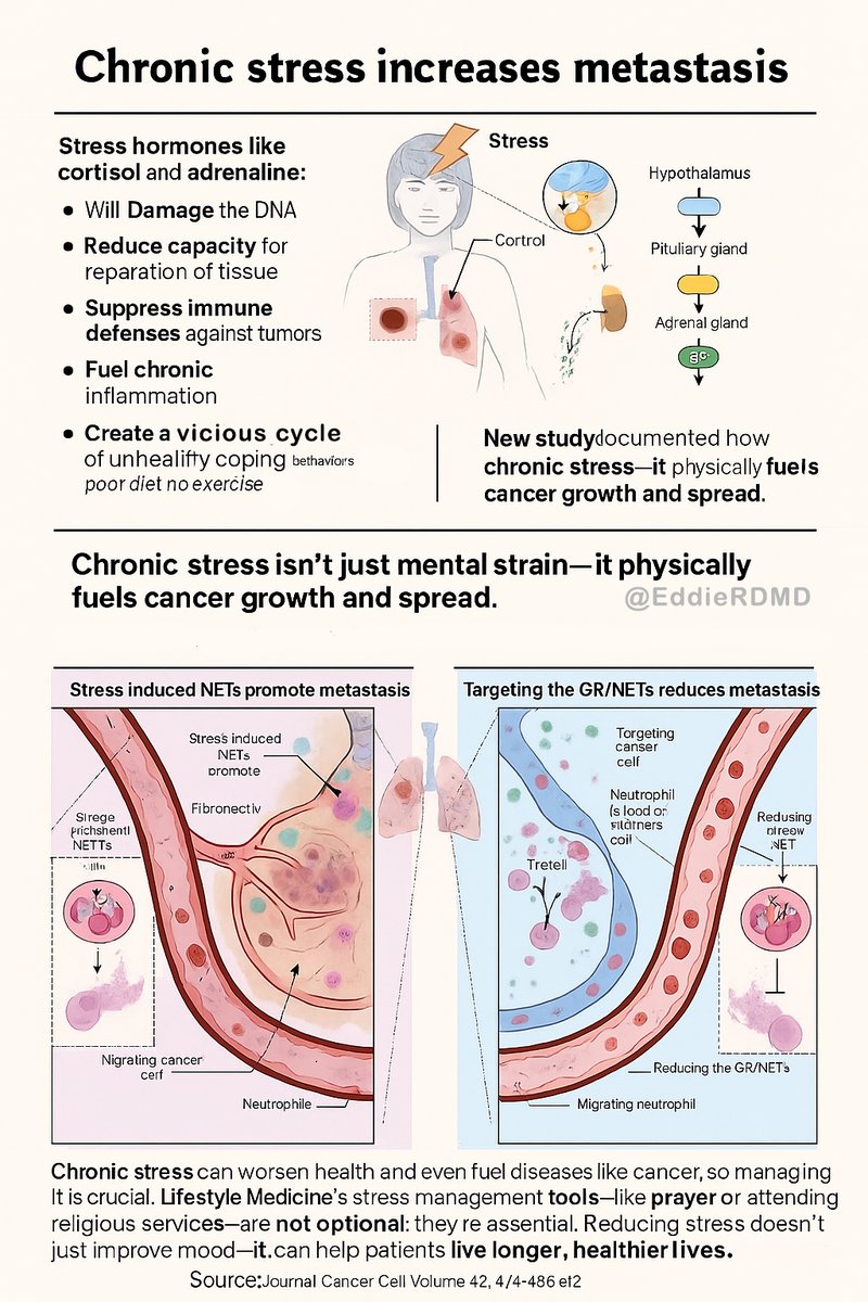 Dr. Eddie Ramirez (@eddierdmd) on Twitter photo Journal Cell:
🚨 Chronic Stress Fuels Cancer Progression!
😱 Stress hormones double cancer metastasis by altering immune defenses.
🫁 Blocking stress pathways stopped the spread!
🛑 Stress management is key in cancer care. 🧘♀️ #LifestyleMedicine cell.com/cancer-cell/fu… <a href="/_atanas_/">Atanas G. Atanasov</a> Journal Cell:
🚨 Chronic Stress Fuels Cancer Progression!
😱 Stress hormones double cancer metastasis by altering immune defenses.
🫁 Blocking stress pathways stopped the spread!
🛑 Stress management is key in cancer care. 🧘♀️ #LifestyleMedicine cell.com/cancer-cell/fu… <a href="/_atanas_/">Atanas G. Atanasov</a>