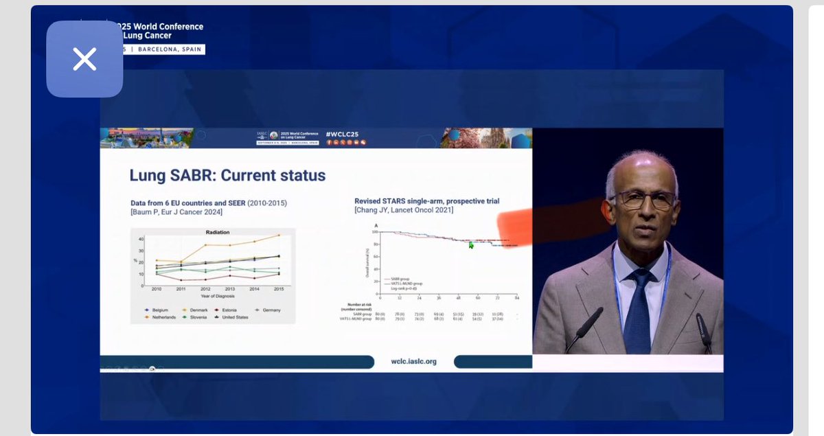 Great talk by Dr. Suresh Senan <a href="/amsterdamumc/">Amsterdam UMC</a> <a href="/IASLC/">IASLC</a> #WCLC25 on using AI to improve radiotherapy delivery to reduce radiation-related toxicities. Radiation is key part #lungcancer treatment.