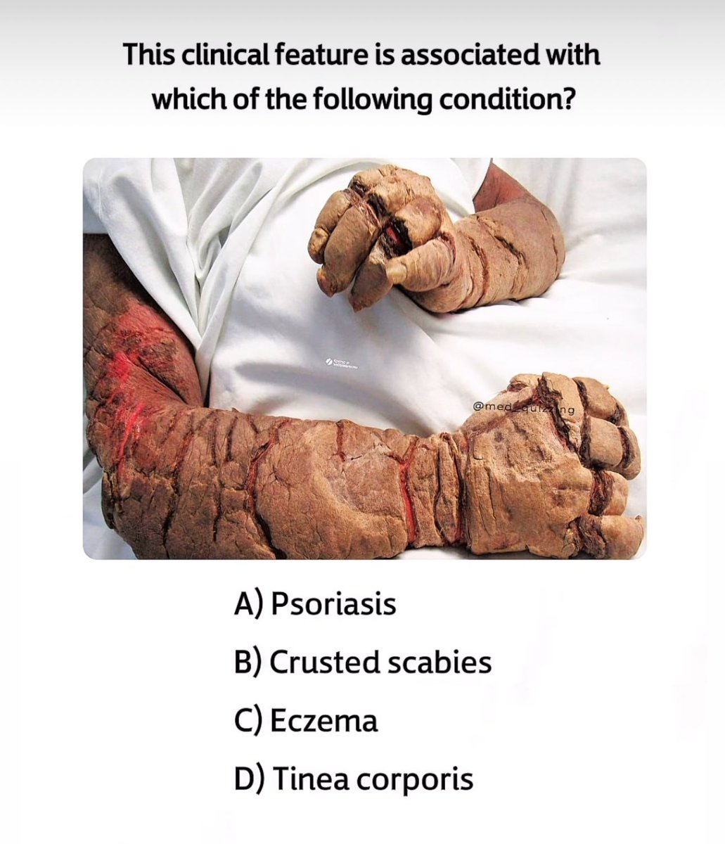 Question 🙋 

✨👀✨