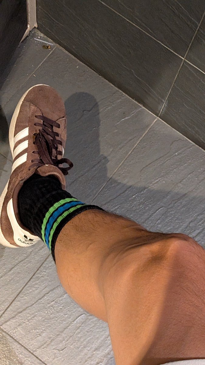 （日前畫面）
不是很懂那個血管是發生什麼事，靜脈曲張ㄇ