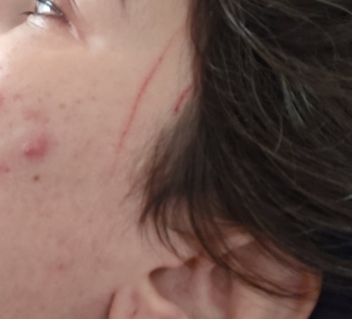 Хтось не спав вночі через комарів чи шахеди, але мало кому кіт вночі уїбав в скроню, бо тікав від кішки, яка постійно його булить. Досі болить...