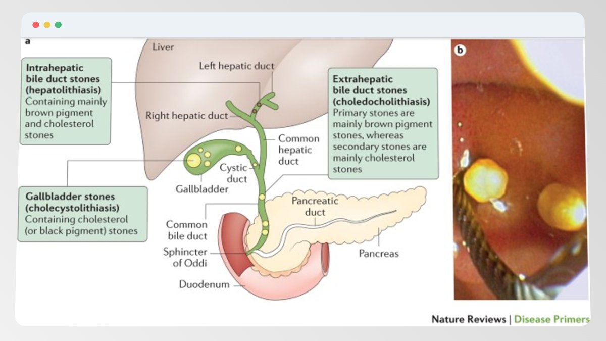 EndoCollab™ | GI Endoscopy Community tweet media