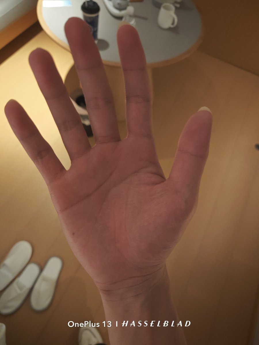 有人拿pg打我的手，好疼！