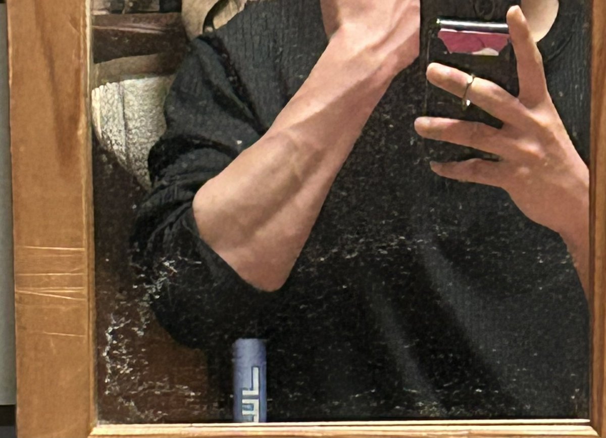koshilogftm's tweet photo. ホルモン注射から約1年
皮下脂肪がどんどん落ちて
最近は下腹部まで血管が出てきた
めっちゃ嬉しいけど
ずっと打たねばならぬ〜というめんどくささ。
でもしゃぁないし
この身体で楽しまねばという気持ち
しんどいけどねw https://t.co/iaNirwNxbW