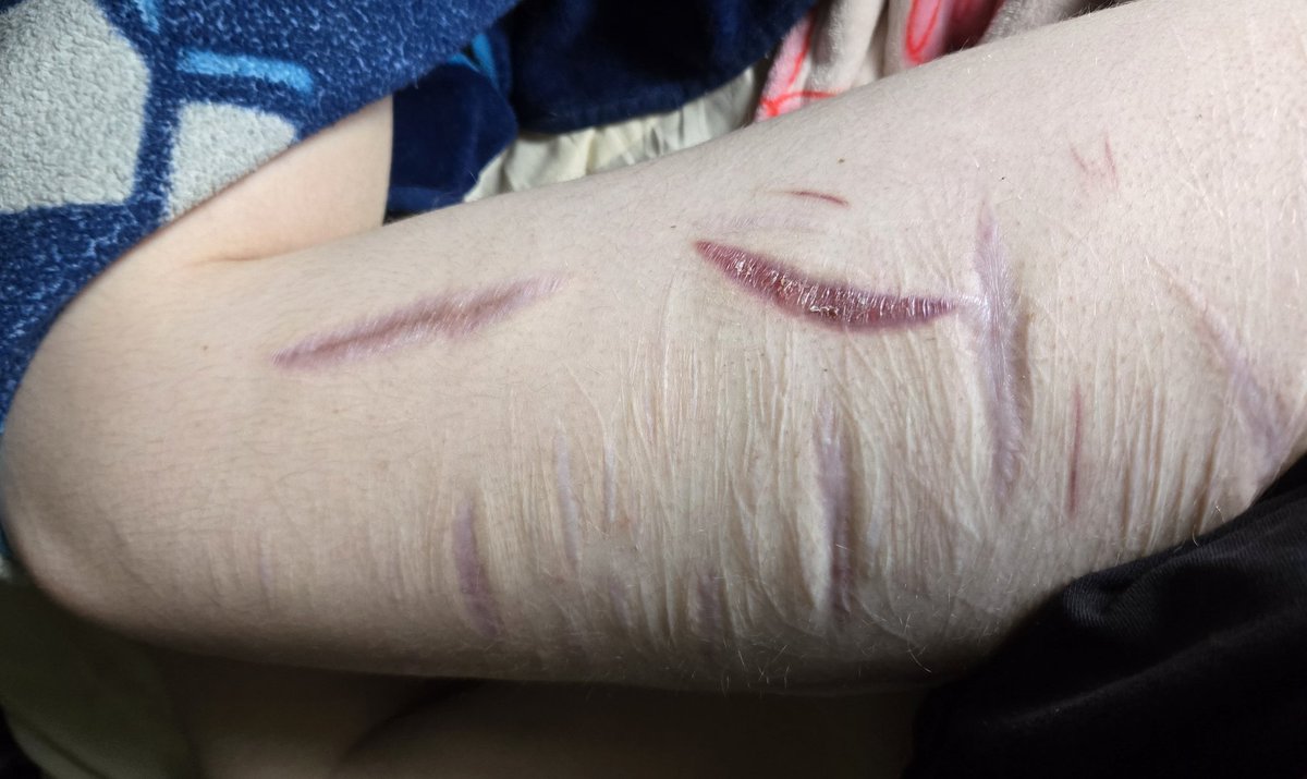 🏳️ ᵀᵃʸˡᵉⁿᶻ ⌁ tweet media