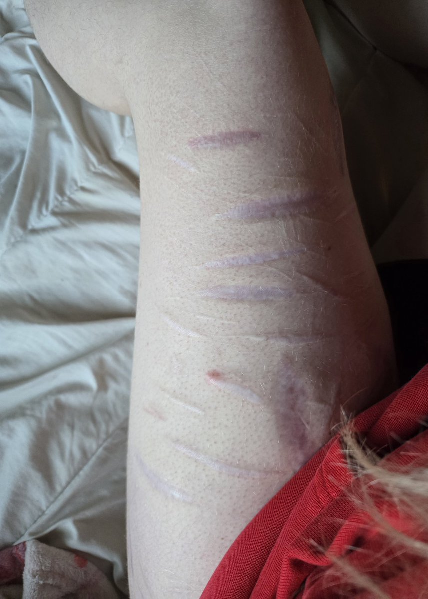 🏳️ ᵀᵃʸˡᵉⁿᶻ ⌁ tweet media