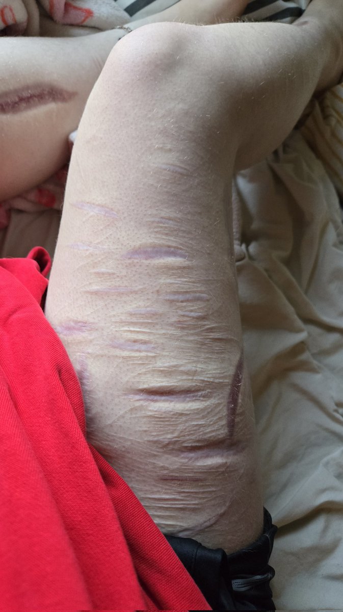 🏳️ ᵀᵃʸˡᵉⁿᶻ ⌁ tweet media