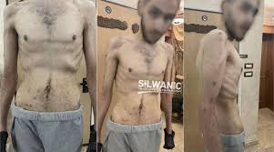 The Israeli Supreme Court has determined that Israel is starving its Palestinian prisoners and has to provide enough sustenance “to enable a basic existence.” There is no doubt. Israel has been starving prisoners, often to death. Just as it has been starving innocent Gazans to