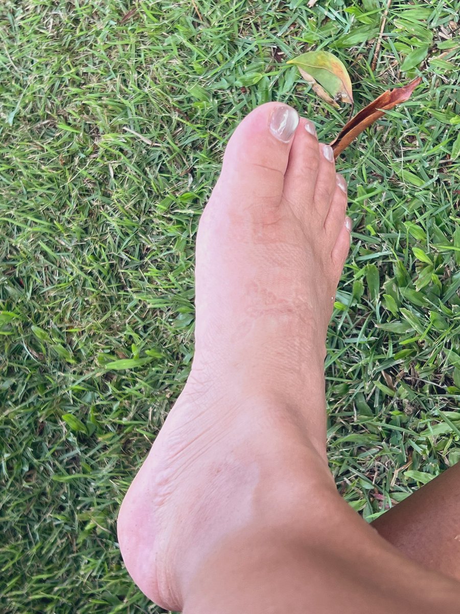 Lady__CJ's tweet photo. After a long run, swollen feet
#Fwf #feetfetısh #feetworshi̇p #nails https://t.co/NFTxRDcCCo
