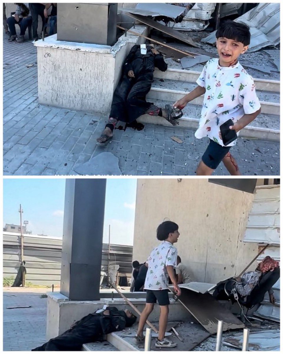 ⚡️Euro-Med human rights Monitor: 

 An injured Palestinian child stands beside his father, whose head has been crushed, while nearby lies a pregnant woman in her early months, killed on the hospital steps in an Israeli strike.