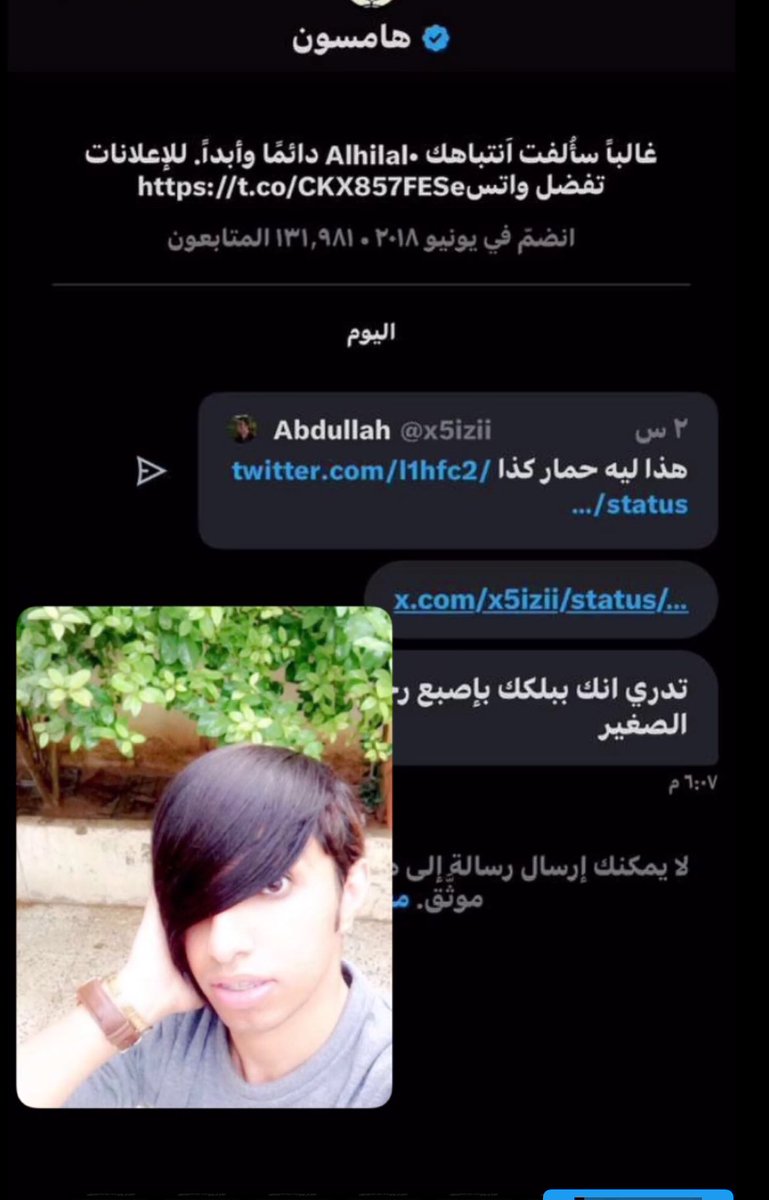 تدري  " انك " ببلك بإصبع رجلي الصغير 🦋🦋