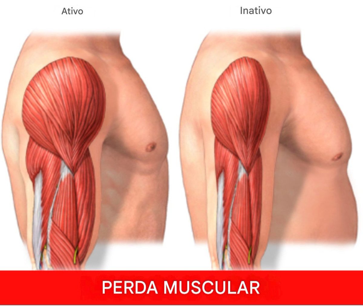 SUPER THREAD 🧵 SOBRE COMO A PERDA MUSCULAR COM O PASSAR DOS ANOS AFETA SUA VIDA TE LEVANDO A MORTE ⚰️ 

Após os 30 anos, os homens perdem até 5% de seus músculos a cada década.

Aos 60 anos, a maioria não consegue subir escadas sem dor.

Pior ainda?

A perda muscular é o