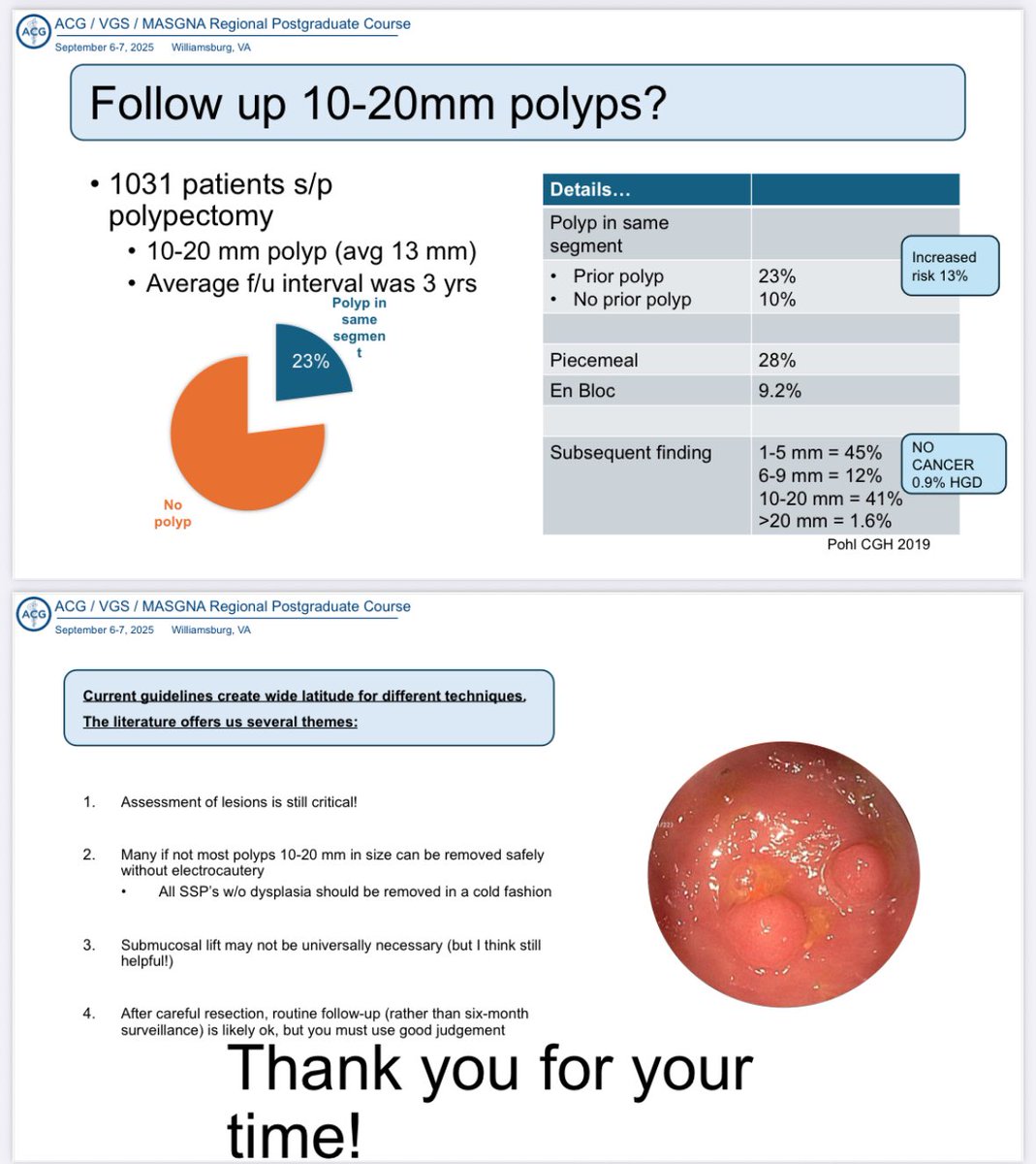 Virginia Gastroenterological Society (@virginiagastro) on Twitter photo Polypectomy Techniques for the 16-mm Polyp | Dr. Andrew Copland <a href="/uvagastro/">UVA GI Hep</a>
▶️ Serrated polyps don’t require hot snare 🥶
▶️ Underwater EMR valuable for 10-20 mm polyp 🤿
▶️ Lifting does not benefit polyps 10- 20 mm, but “I believe in lifts” to visualize 👠
🥁 #Williamsburg Polypectomy Techniques for the 16-mm Polyp | Dr. Andrew Copland <a href="/uvagastro/">UVA GI Hep</a>
▶️ Serrated polyps don’t require hot snare 🥶
▶️ Underwater EMR valuable for 10-20 mm polyp 🤿
▶️ Lifting does not benefit polyps 10- 20 mm, but “I believe in lifts” to visualize 👠
🥁 #Williamsburg
