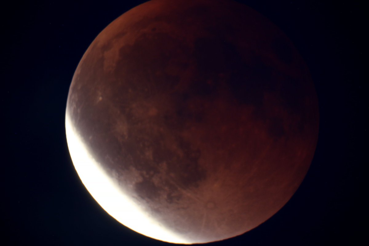 Le Pédonculé tweet media