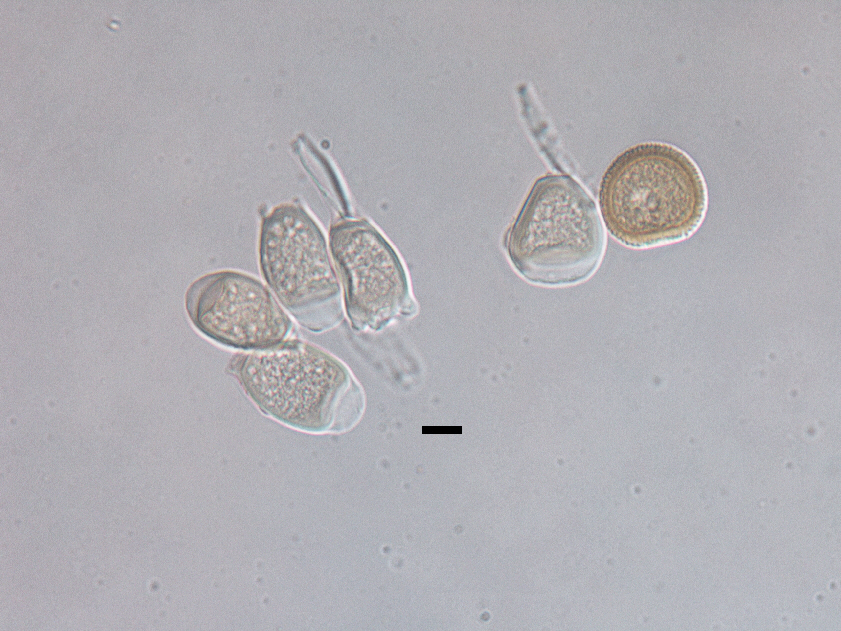 striiformis's tweet photo. #RustOfTheWeek
#Uromyces_savulescui
Uromyces savulescui Rayss, II+III, on Limonium sinuatum (Plumbaginaceae), Cajamarca, Peru
Cinnamon brown densely verrucose urediniospores and colorless teliospores https://t.co/TqLSWJQbSL https://t.co/hESIdgsXzK