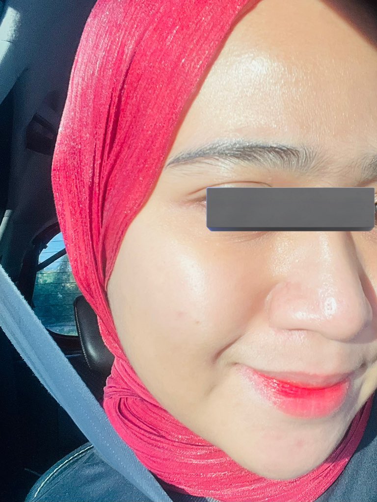 secretlyfura's tweet photo. GIRLS. Dgr cakap dermatologist-

Boleh je achieve skin glowing with the right way-skincare, supplement &amp; healthy lifestyle. Ni buktinya: https://t.co/5oVAy0jeyJ