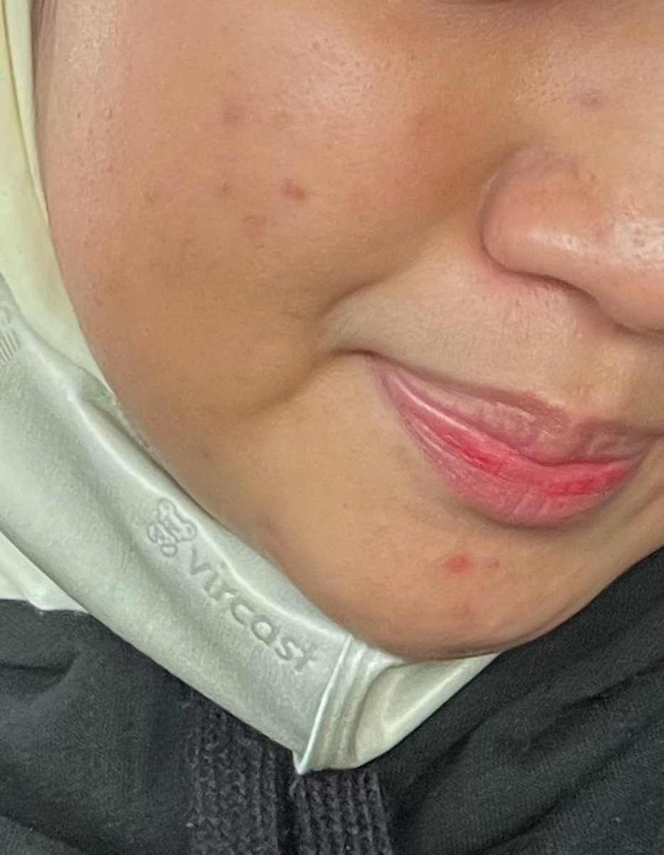 secretlyfura's tweet photo. GIRLS. Dgr cakap dermatologist-

Boleh je achieve skin glowing with the right way-skincare, supplement &amp; healthy lifestyle. Ni buktinya: https://t.co/5oVAy0jeyJ