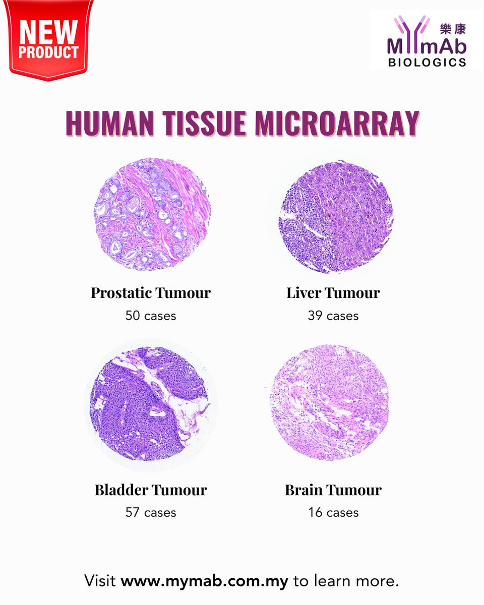 MYmAb_Biologics's tweet image. 🎊Introducing our newly launched Tissue Microarray (TMA) series, featuring liver, bladder, prostate, and brain tumour TMAs.🎯🔬
Reach out to our team today to learn more about our ArrayZeal™ platform and our products.
#mymabbiologics #lifesciences #tissuemicroarray