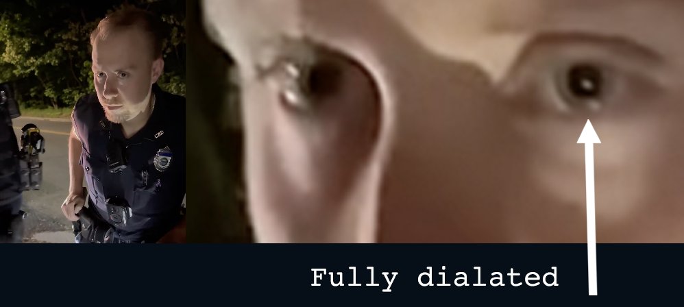 The resolution is clear enough to see that the Lynn Police officer’s pupils were extremely dilated. Officers themselves are trained to recognize this as a potential sign of alcohol or drug use. Whether it’s substance-related or a medical issue, I genuinely hope he gets the help