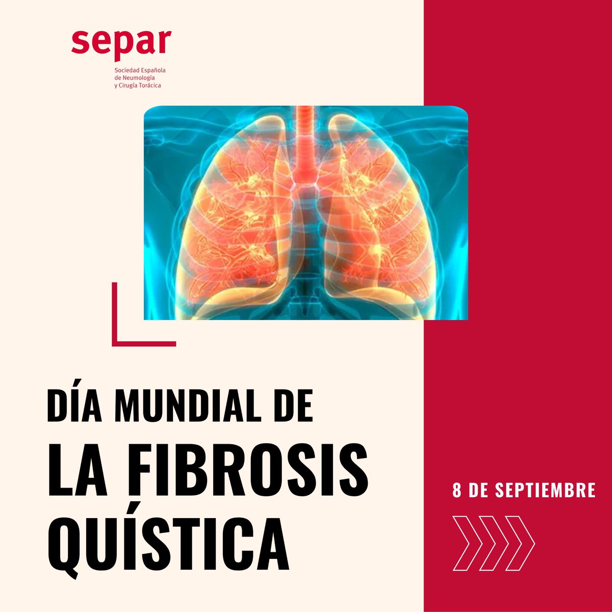 SeparRespira tweet media