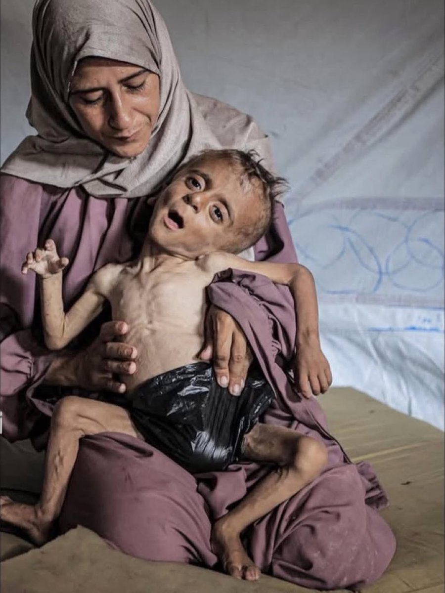 Don’t forget… Israel is starving tens of thousands of Gaza’s children, who are collapsing daily before the cameras of the entire world.