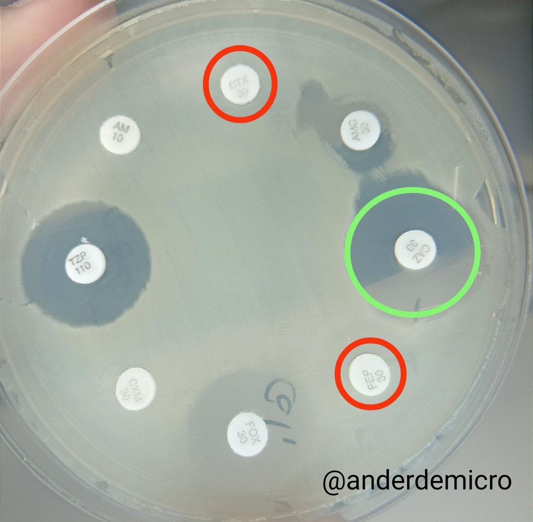 Ander González-Sarría tweet media