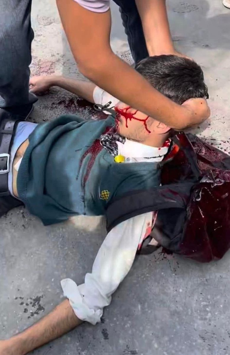 trawasthi_ai's tweet image. 🚨 20-22 Students/Youths k!lled so far in the #GenZprotestnepal 💔. 

Current Nepal Government is a murderer! KP Oli, Sher Bahadur Deuba, Prachand - these 3 goons murdered 3 generations of my nation. How can we digest this? 

PS. This protest was against Corruption, not social…