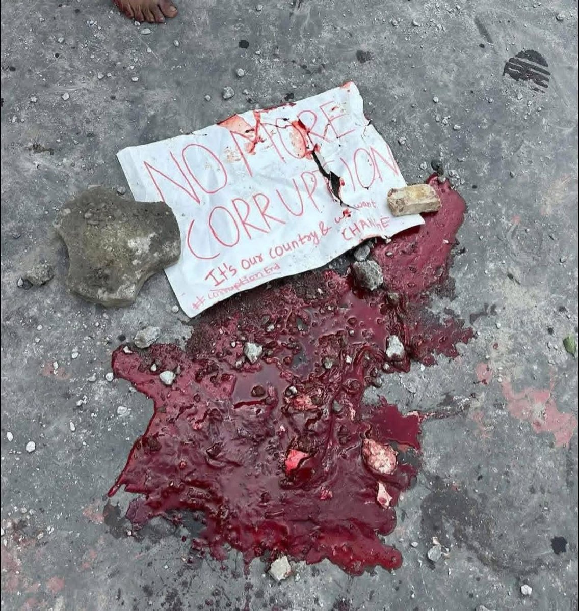 आजसम्म gen z को प्रदर्शन थियो  अब यो हामी सबैको हो । अहिले नबोले कैले बोल्ने ? जिन्दगी झोले भएर कट्दैन है...बेलैमा नागरिक भएर सोचौं !!
हत्यारा सरकार मुर्दावाद!!!
#EnoughIsEnough #genz #Nepalprotest #Nepal