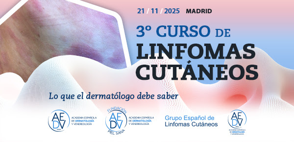 3º Curso de Linfomas Cutáneos: Lo que el dermatólogo debe saber. 
Dirigido a: Adjuntos y residentes R3 y R4 de dermatología. 21 de noviembre de 2025. Presencial

curso-linfoma.aedv.es