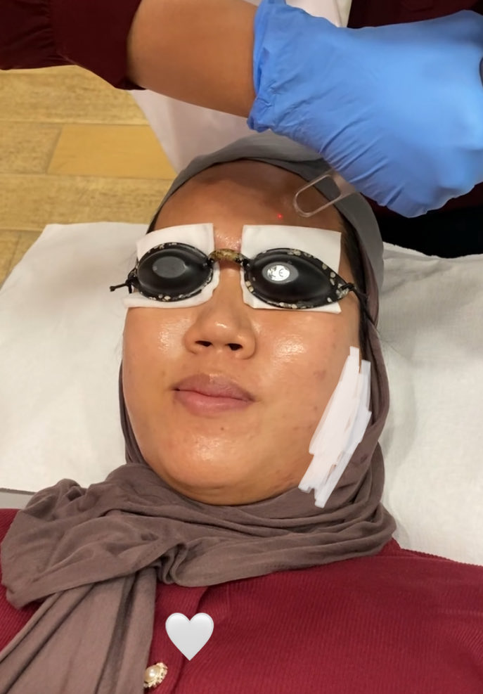 Aku kira pico laser tuh bakal instan glowing, ternyata kuncinya bukan cuma treatment, tapi juga aftercare-nya🫢

Sharing pengalamanku treatment Brightening Pico Laser di @dermiesmax!