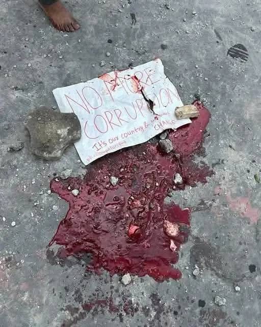 सहयोगको आह्वान !

सिभिल अस्पताल, वीर र ट्रमा सेन्टरका चिकित्सकहरूका अनुसार घाइतेहरुको उपचारका लागि रगतको अभाव भइरहेको छ।

युवाहरुको बगेको रगतलाई रगतकै माग भएको छ। कृपया सहयोगी हातहरु जहाँ भएपनि भावी पुस्ताको ज्यान जोगाउन अस्पताल पुगौँ र यो पोष्ट सक्दो धेरै पोस्ट गरौँ !