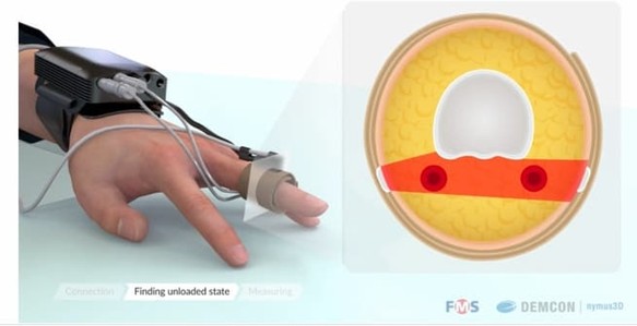finapres's tweet image. It is Know Your Numbers! Week.

Did you know that low blood pressure in combination with other symptoms like dizziness, fainting and nausea can indicate a problem?

It is important that your symptoms are tracked and that your blood pressure is monitored.

#finapres #beattobeat