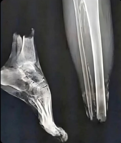 WinamaxSport's tweet image. Médecin de l&apos;équipe de France : &quot;Avant le match, j&apos;avais fait passer une radio à Ousmane Dembélé. Tout semblait ok.&quot;